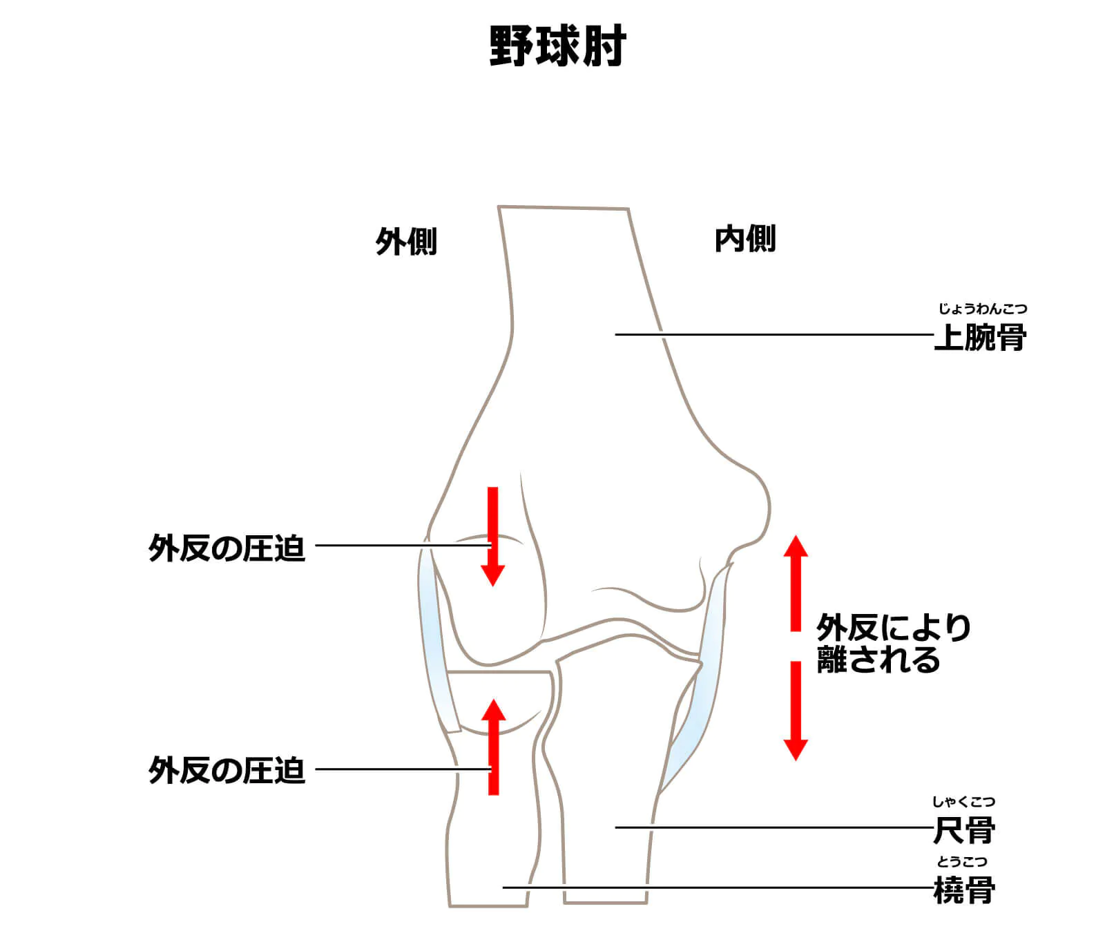 野球肘とは